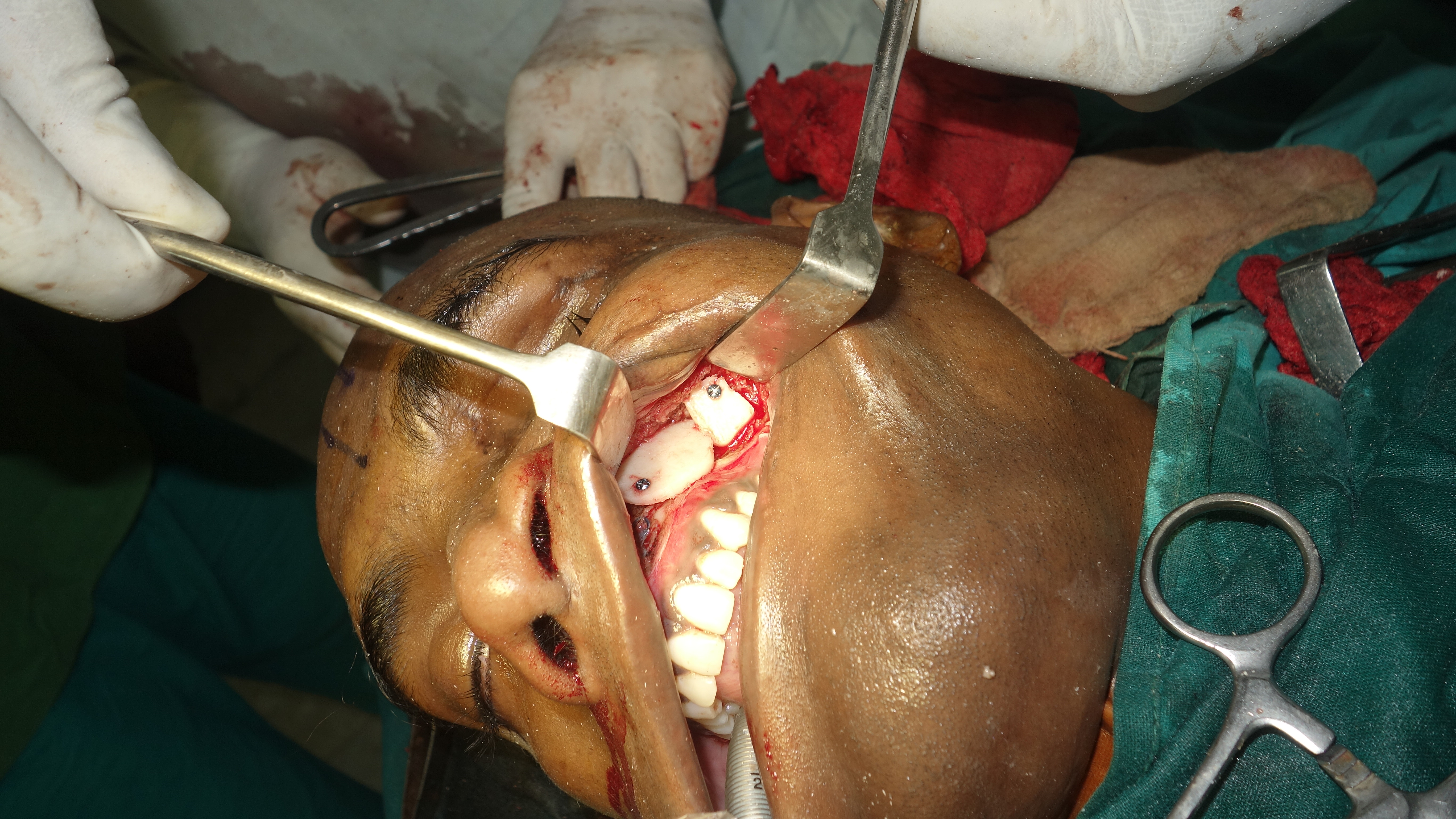 Oral & Maxillofacial Surgery